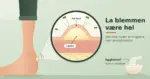 Illustrasjon av en hæl med et gnagsår, der et forstørrelsesglass viser blemmen i tverrsnitt med væske under et helt hudtak som holder bakterier ute, sammen med teksten «La blemmen være hel» og et eggeskall med egghinne merket som bare et nødtiltak.