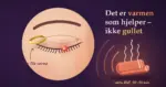 Illustrasjon av et lukket øye med en rød sti på øyelokkskanten, der en gullring stryker fra yttersiden innover mot nesen med påskriften «for lite varme», mens en dampende varm klut sender varmebølger mot øyet under teksten «Det er varmen som hjelper – ikke gullet».