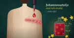 Illustrasjon av en rygg med et belte av rødt helvetesildutslett og blemmer langs en nerve fra ryggraden, der en pipette drypper rød johannesurtolje mot utslettet, ved siden av en glassflaske med rødolje og gule johannesurtblomster, med teksten «Johannesurtolje mot helvetesild – virker det?».
