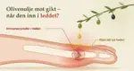 Illustrasjon av en fot sett fra siden der en oljedråpe drypper fra en olivengren ned på det røde, betente stortåleddet og blir liggende som en gyllen hinne på huden, mens et gjennomskåret ledd viser hvite urinsyrekrystaller inne i leddet, sammen med teksten «Olivenolje mot gikt – når den inn i leddet?».
